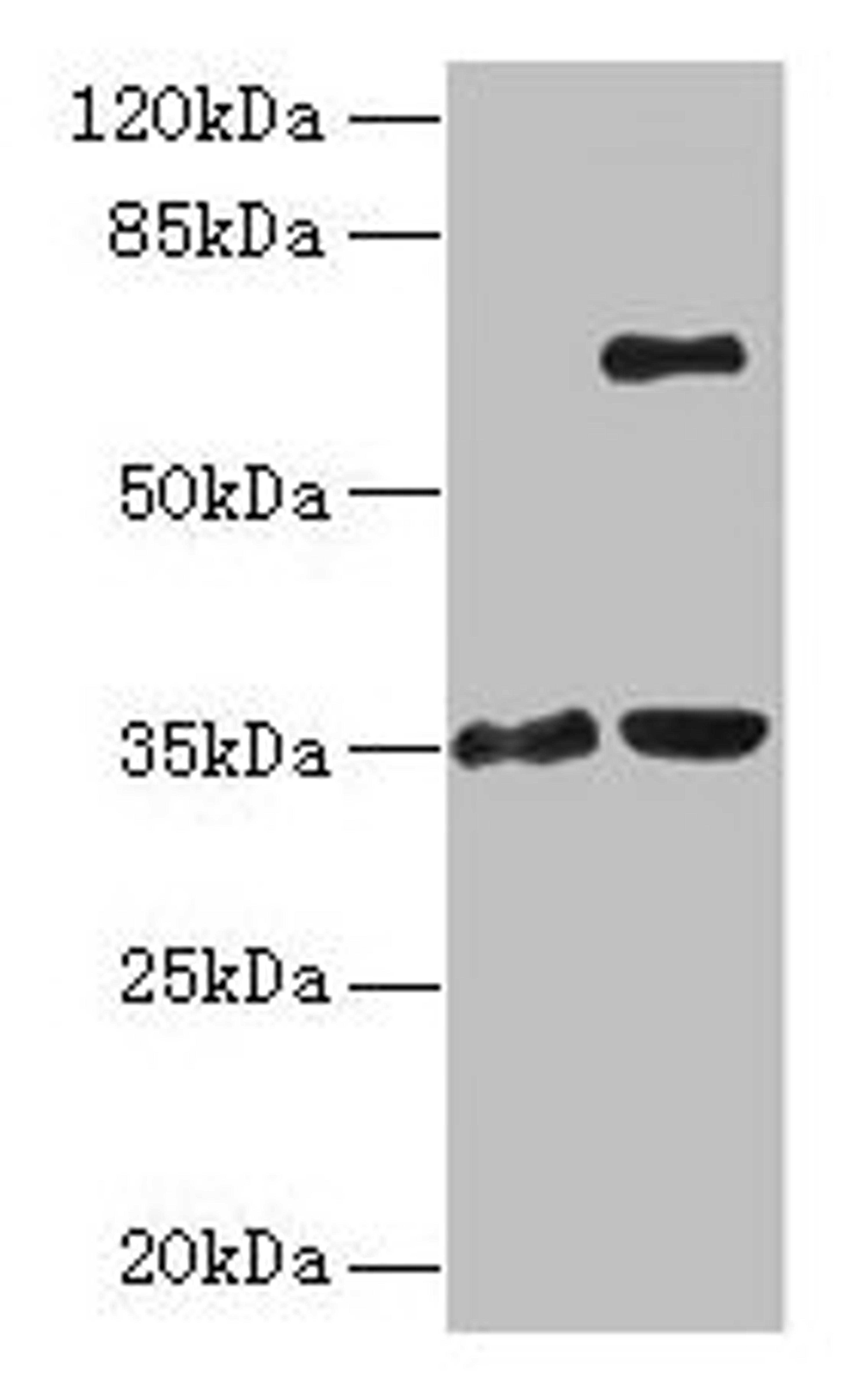 Western blot. All lanes: ZNF75A antibody at 10µg/ml. Lane 1: Mouse brain tissue. Lane 2: Mouse liver tissue. Secondary. Goat polyclonal to rabbit IgG at 1/10000 dilution. Predicted band size: 35 kDa. Observed band size: 35, 65 kDa