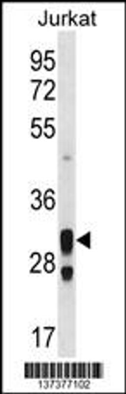 Western blot analysis in Jurkat cell line lysates (35ug/lane).