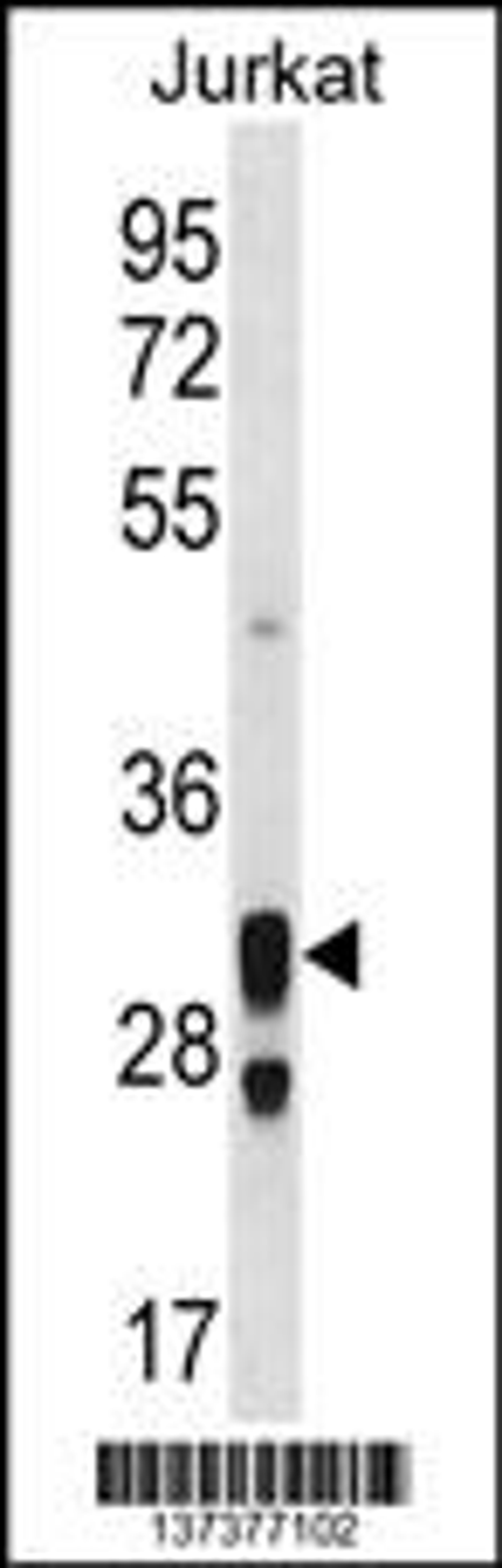 Western blot analysis in Jurkat cell line lysates (35ug/lane).