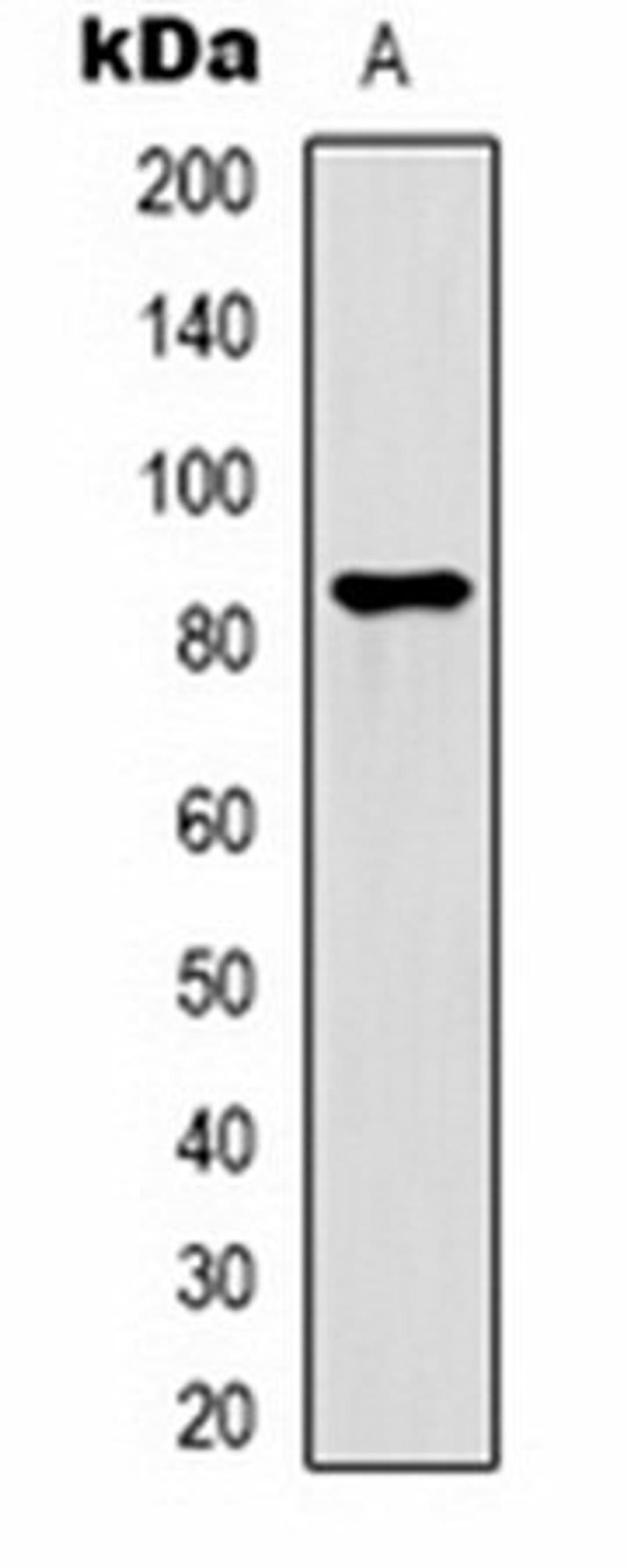 Western blot analysis of  HepG2 (Lane1) whole cell lysates using PI3K p85 beta antibody