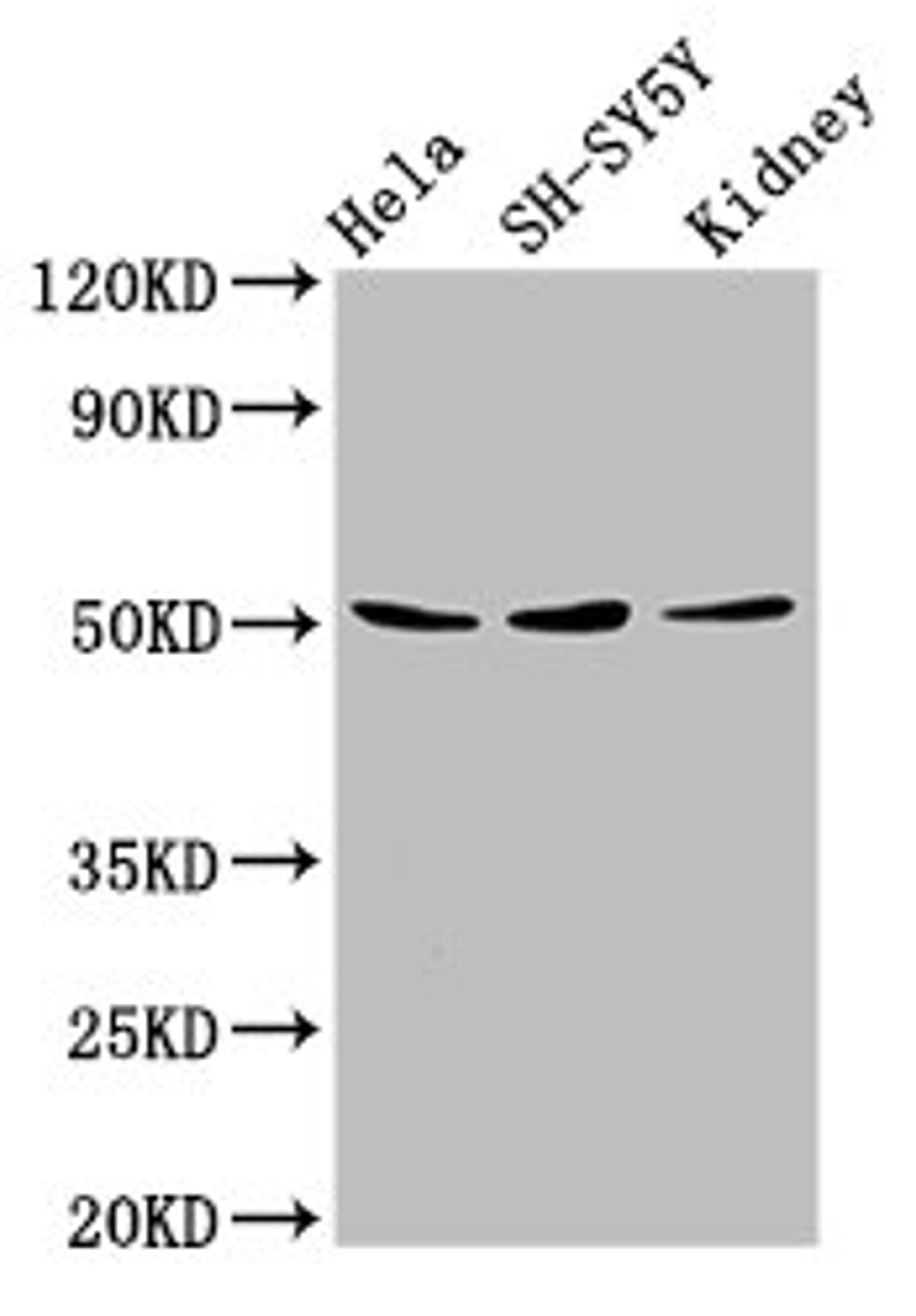 Western Blot. Positive WB detected in: Hela whole cell lysate, SH-SY5Y whole cell lysate, Mouse kidney tissue. All lanes: RARG antibody at 8µg/ml. Secondary. Goat polyclonal to rabbit IgG at 1/50000 dilution. Predicted band size: 51, 50, 43, 48 kDa. Observed band size: 51 kDa