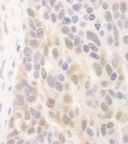 Detection of human SPATA2 by immunohistochemistry.