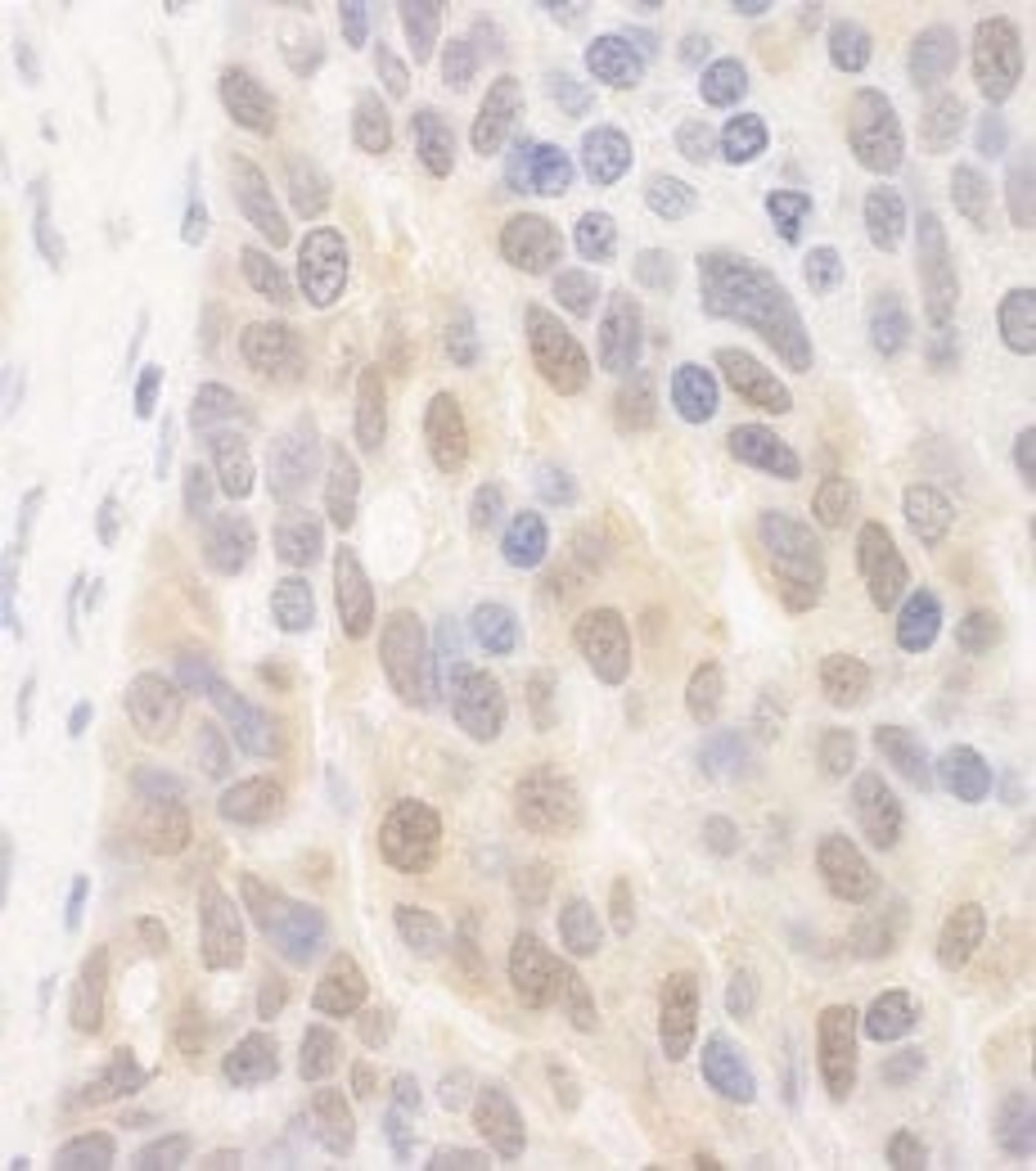 Detection of human SPATA2 by immunohistochemistry.