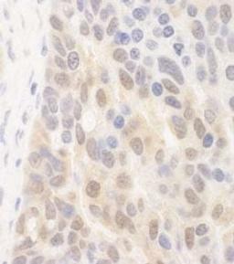 Detection of human SPATA2 by immunohistochemistry.