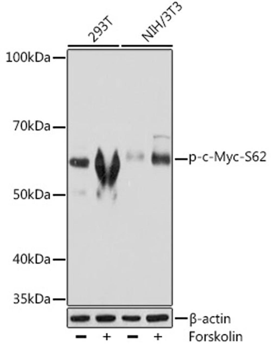 Western blot - Phospho-c-Myc-S62 Rabbit mAb (AP0989)