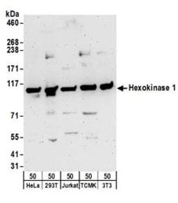 Detection of human and mouse Hexokinase 1 by western blot.