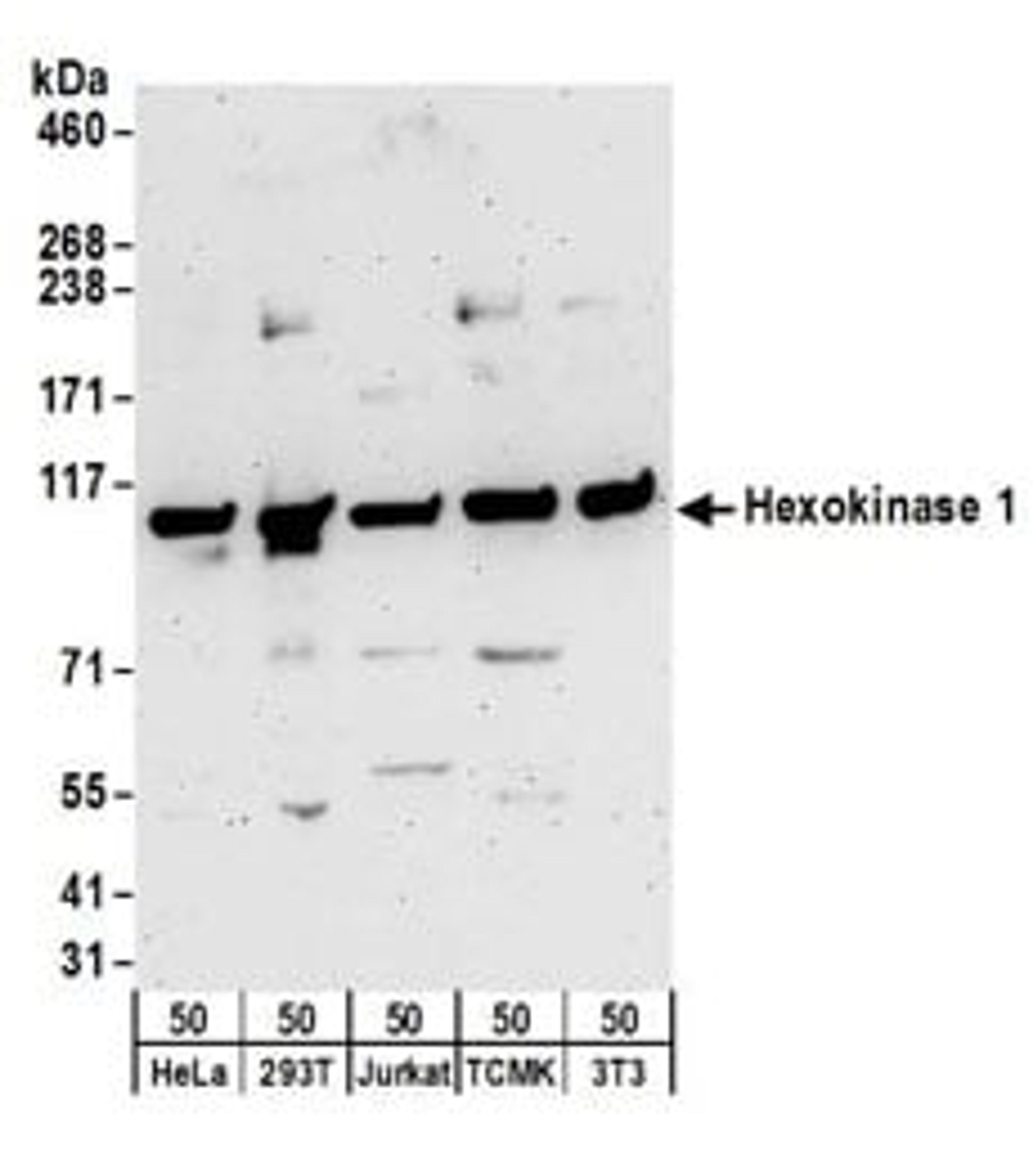 Detection of human and mouse Hexokinase 1 by western blot.