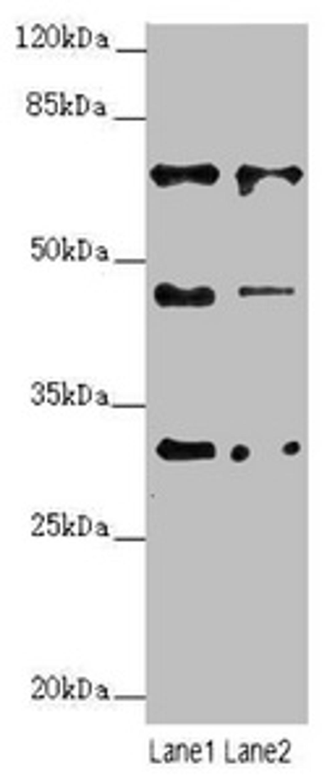 Western blot. All lanes: ZNF785 antibody at 6.27ug/ml. Lane 1: Hela whole cell lysate. Lane 2: PC-3 whole cell lysate. Secondary. Goat polyclonal to rabbit IgG at 1/10000 dilution. Predicted band size: 47, 45 kDa. Observed band size: 47, 65, 30 kDa. 