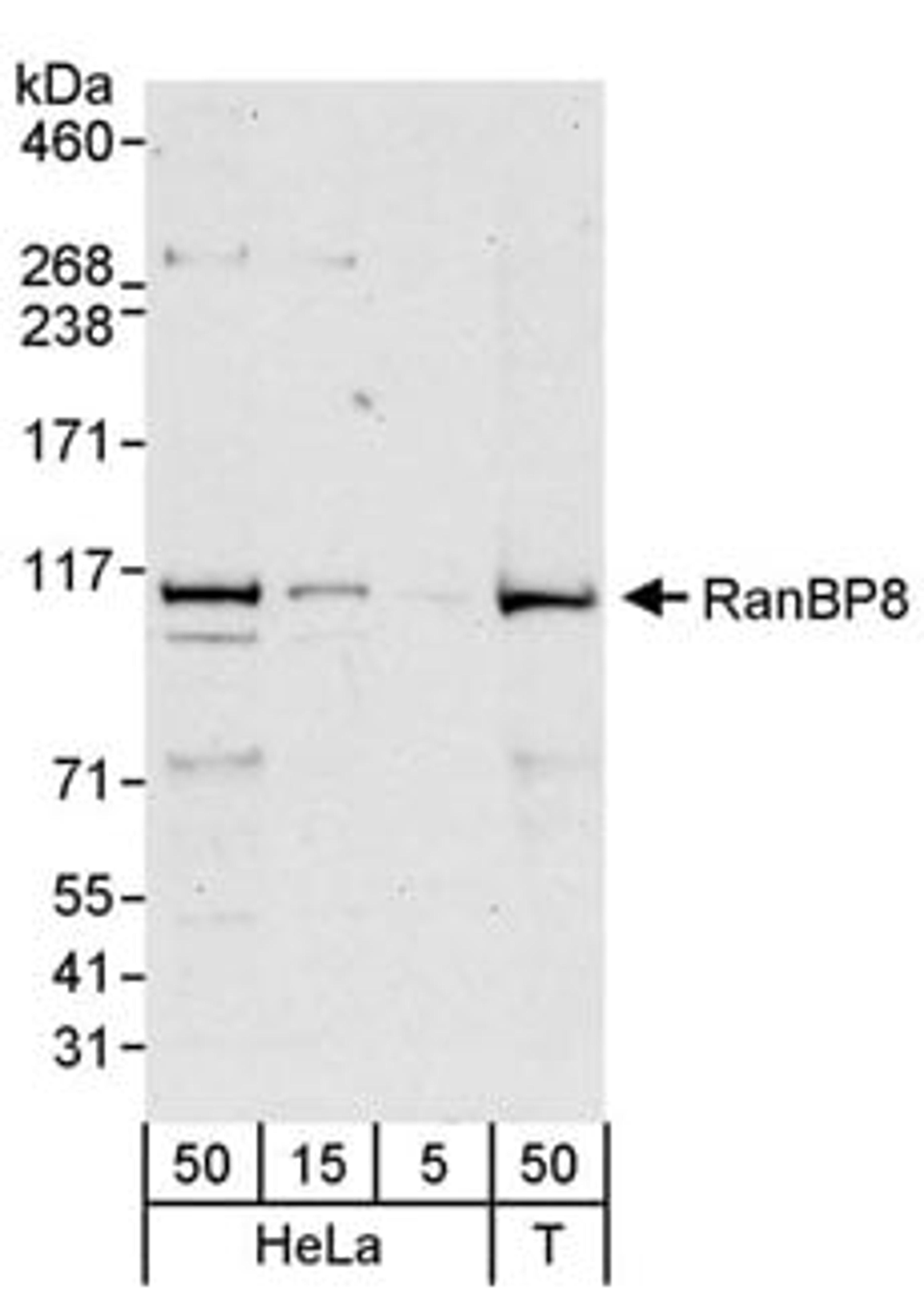 Detection of human RanBP8 by western blot.