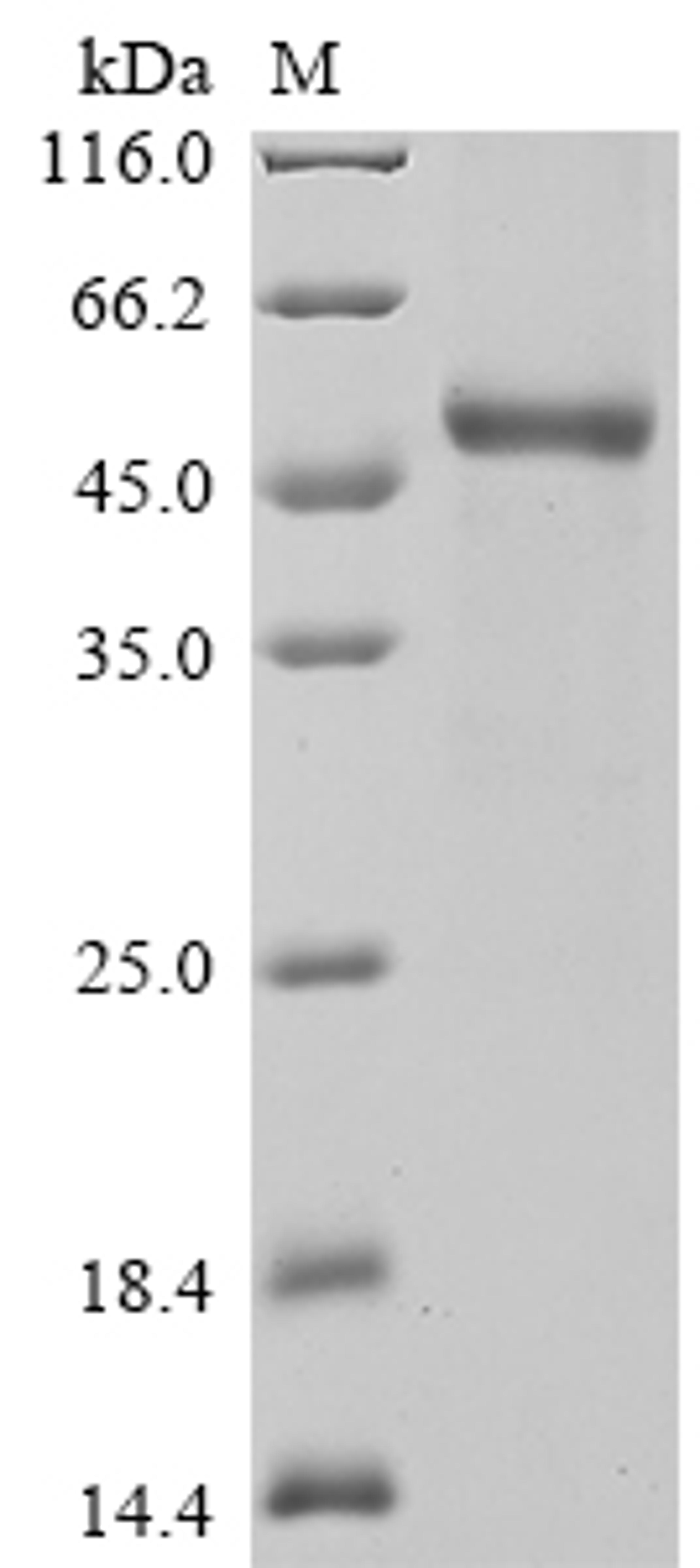 (Tris-Glycine gel) Discontinuous SDS-PAGE (reduced) with 5% enrichment gel and 15% separation gel.