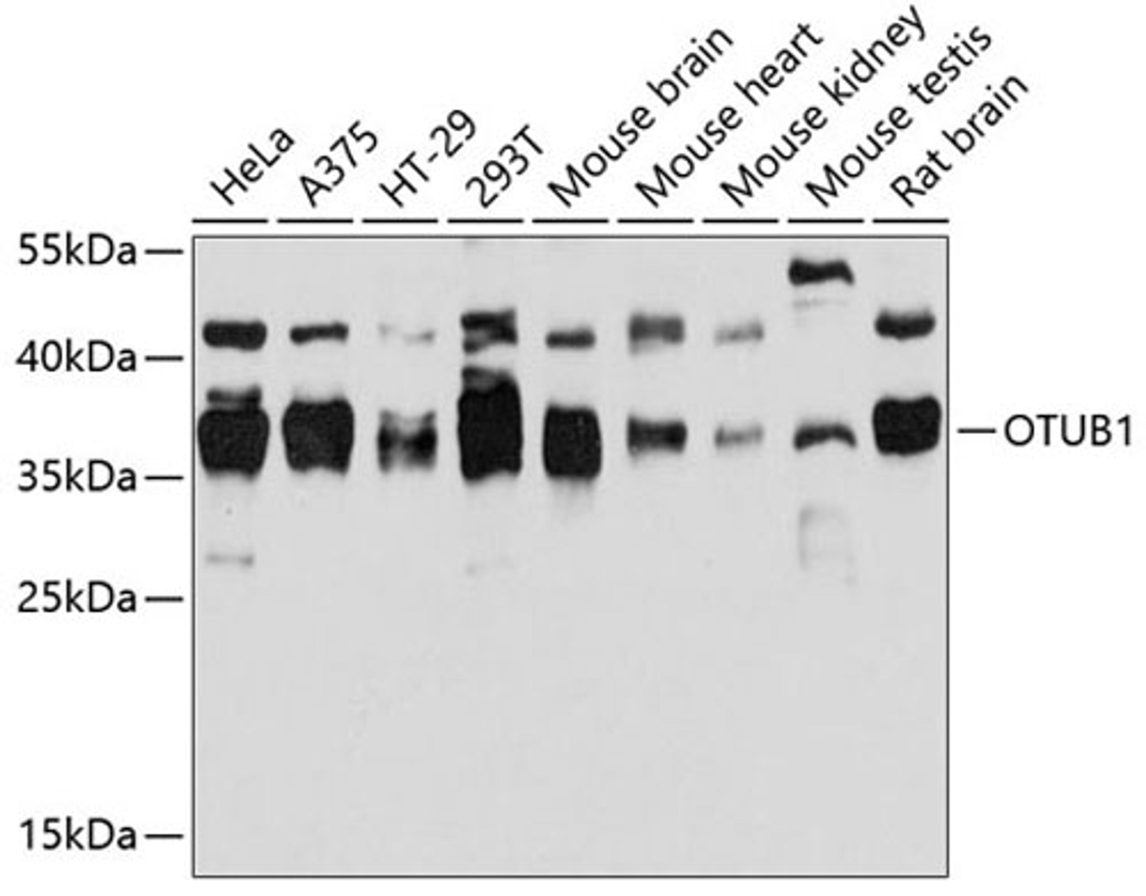 Western blot - OTUB1 antibody (A11656)