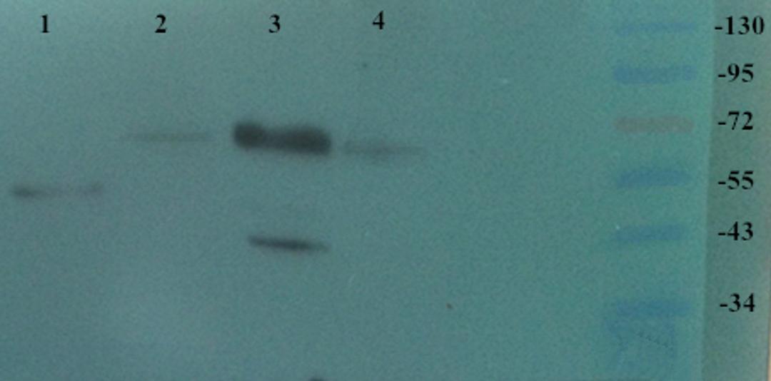 Western blot analysis of Human breast cancer 3 (Lane 1), Mouse kidney (Lane 2), Mouse liver (Lane 3), Rat kidney (Lane 4) using TRPV1 antibody (dilution at 2 ug/ml)