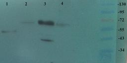 Western blot analysis of Human breast cancer 3 (Lane 1), Mouse kidney (Lane 2), Mouse liver (Lane 3), Rat kidney (Lane 4) using TRPV1 antibody (dilution at 2 ug/ml)