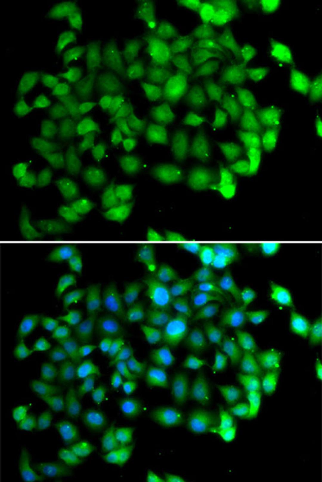 Immunofluorescence - APOBEC3C antibody (A5877)