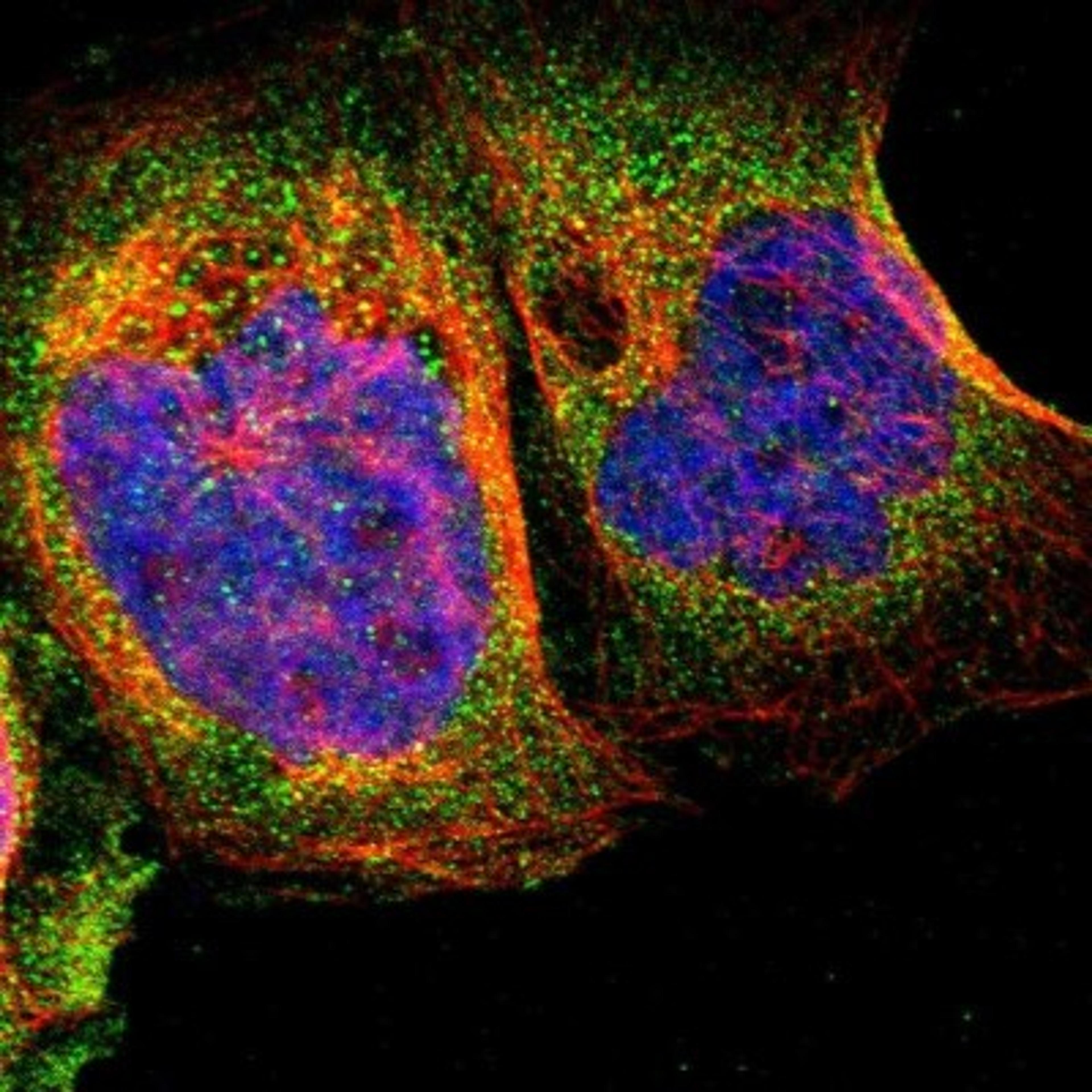 Immunocytochemistry/Immunofluorescence: C22orf36 Antibody [NBP1-93522] - Staining of human cell line A-431 shows positivity in cytoplasm.