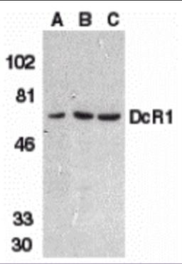 Western blot analysis of DcR1 in HeLa cell (A), mouse (B) and rat (C) liver tissue lysates with DcR1 antibody at 1 &#956;g/mL.