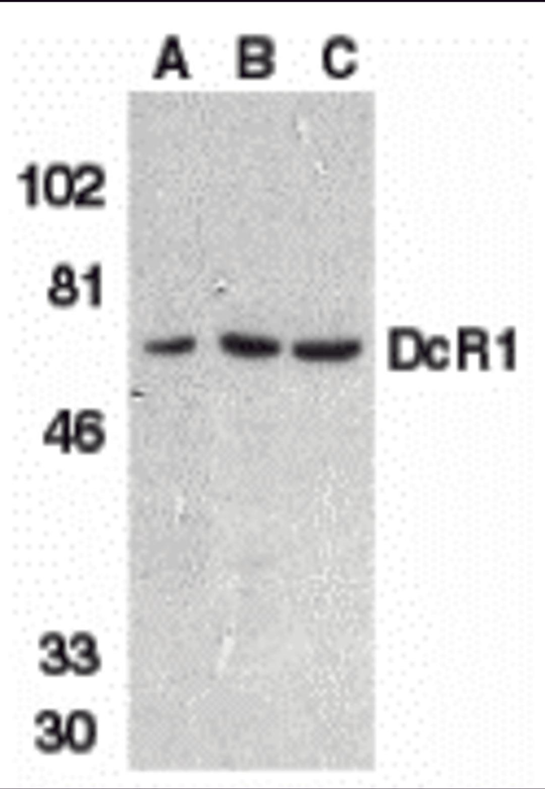 Western blot analysis of DcR1 in HeLa cell (A), mouse (B) and rat (C) liver tissue lysates with DcR1 antibody at 1 μg/mL.
