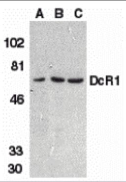 Western blot analysis of DcR1 in HeLa cell (A), mouse (B) and rat (C) liver tissue lysates with DcR1 antibody at 1 μg/mL.