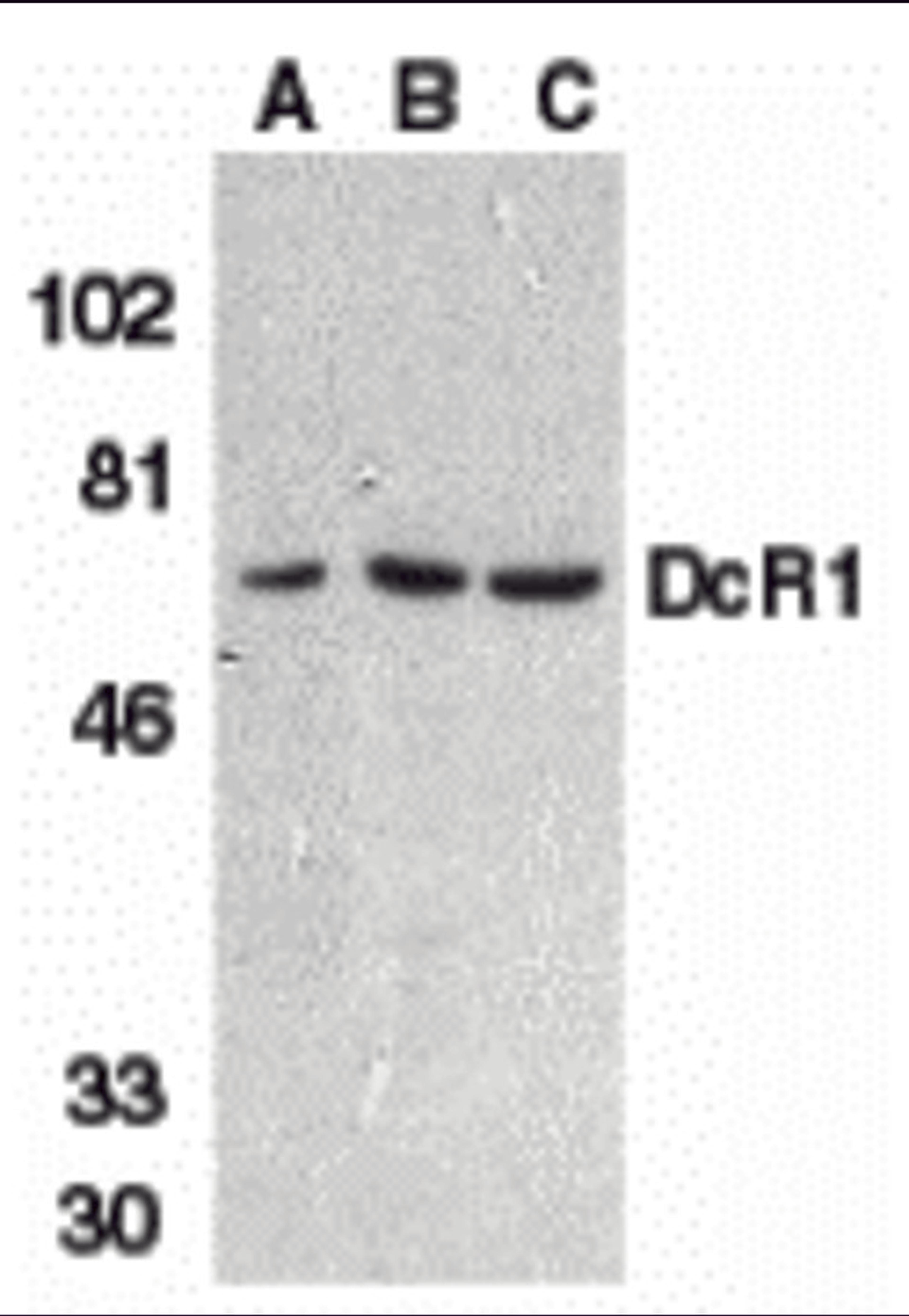 Western blot analysis of DcR1 in HeLa cell (A), mouse (B) and rat (C) liver tissue lysates with DcR1 antibody at 1 μg/mL.