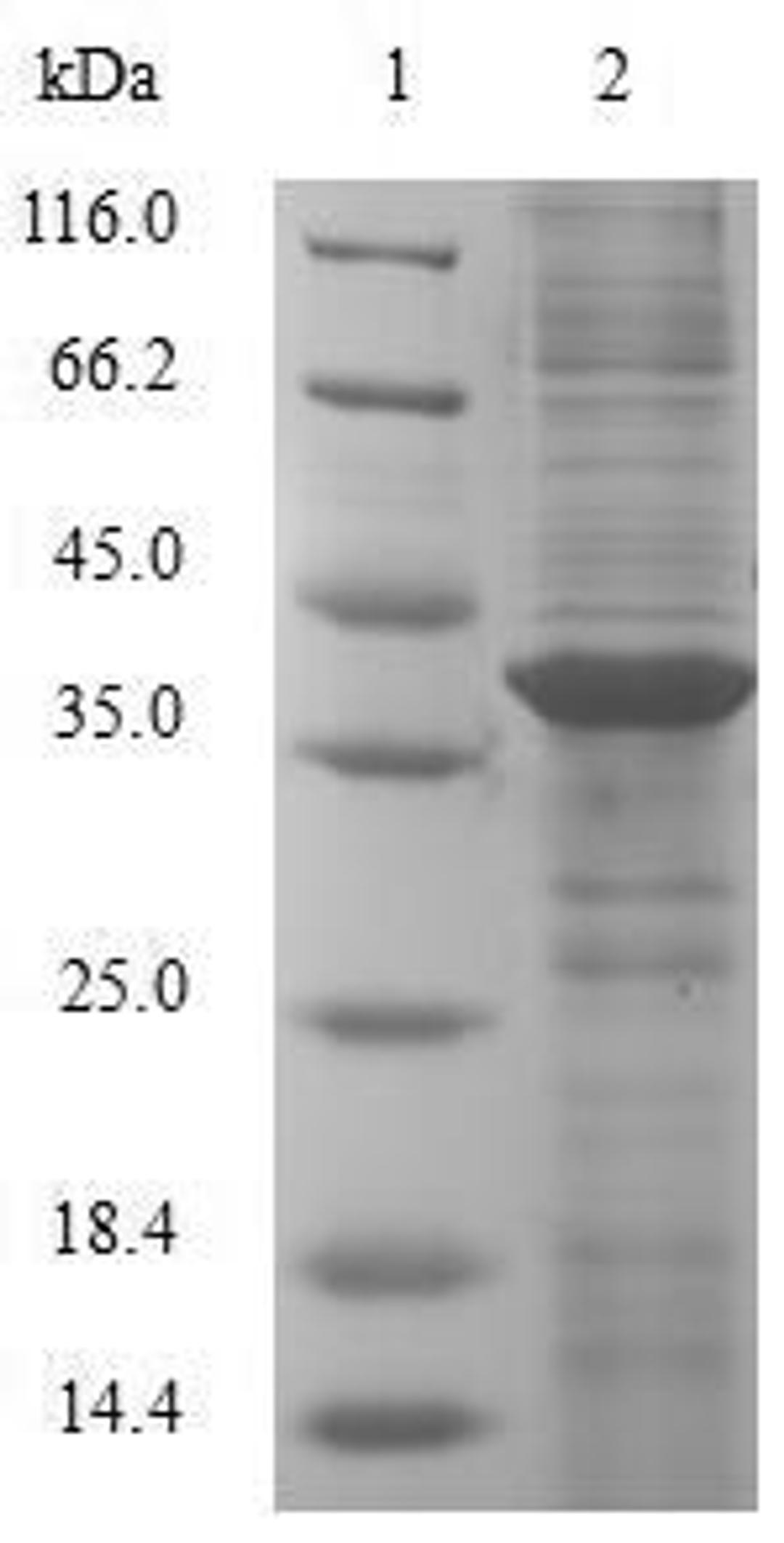 (Tris-Glycine gel) Discontinuous SDS-PAGE (reduced) with 5% enrichment gel and 15% separation gel.
