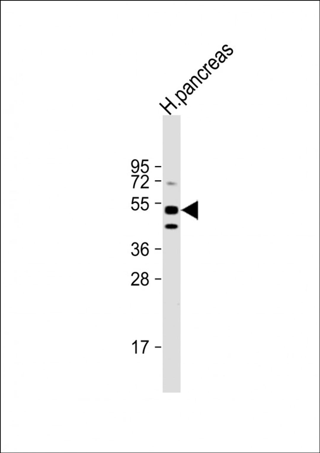 Western Blot at 1:1000 dilution + human pancreas lysate Lysates/proteins at 20 ug per lane.