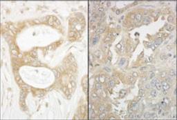 Detection of human and mouse EB1 by immunohistochemistry.