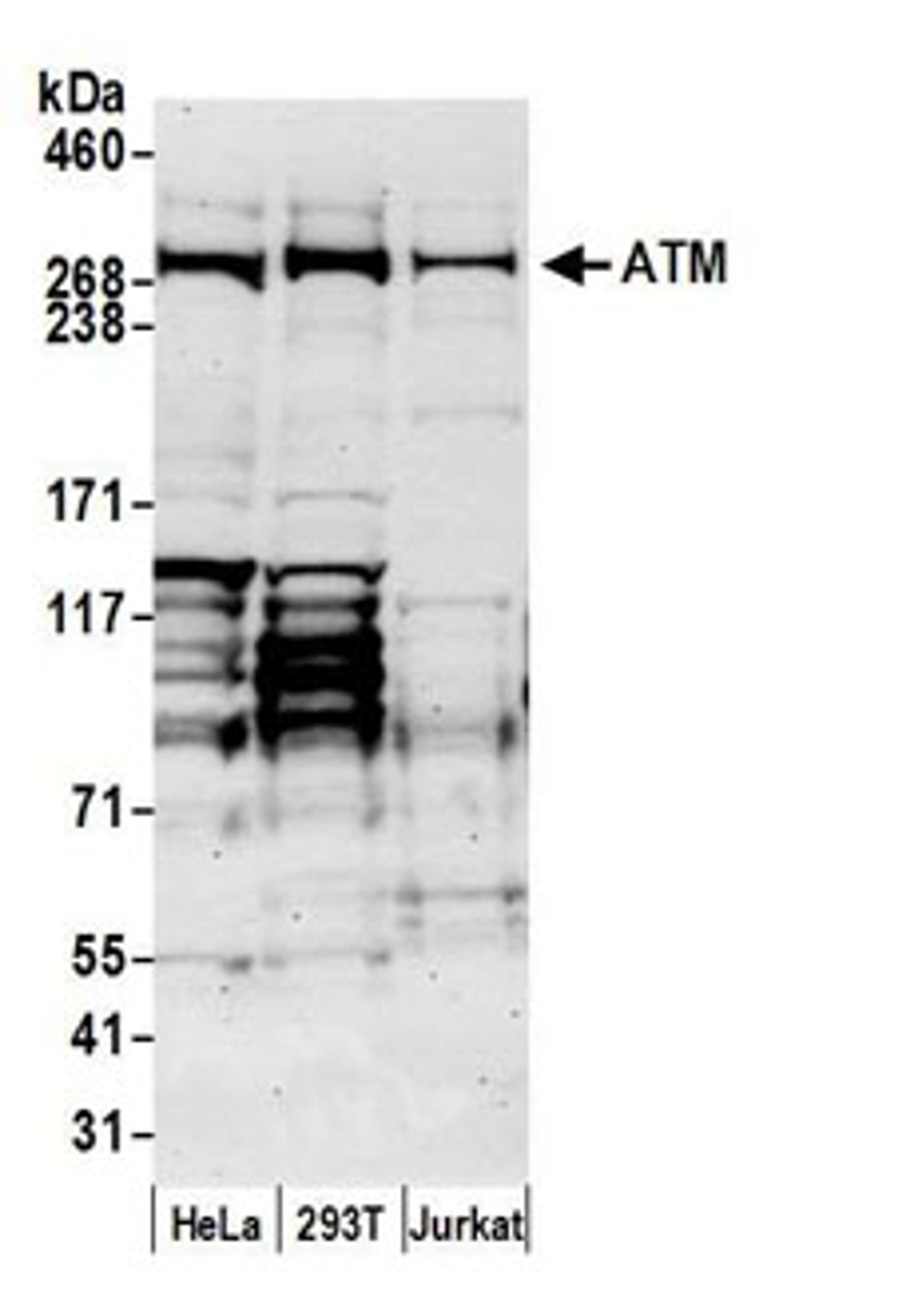 Detection of human ATM by western blot.