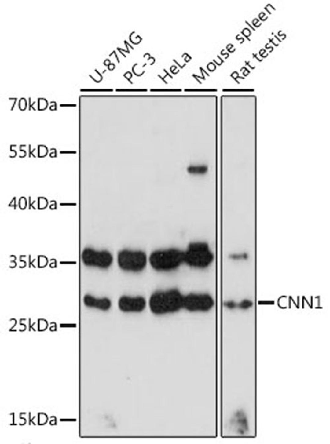 Western blot - CNN1 antibody (A16638)