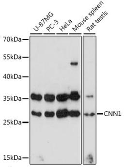 Western blot - CNN1 antibody (A16638)