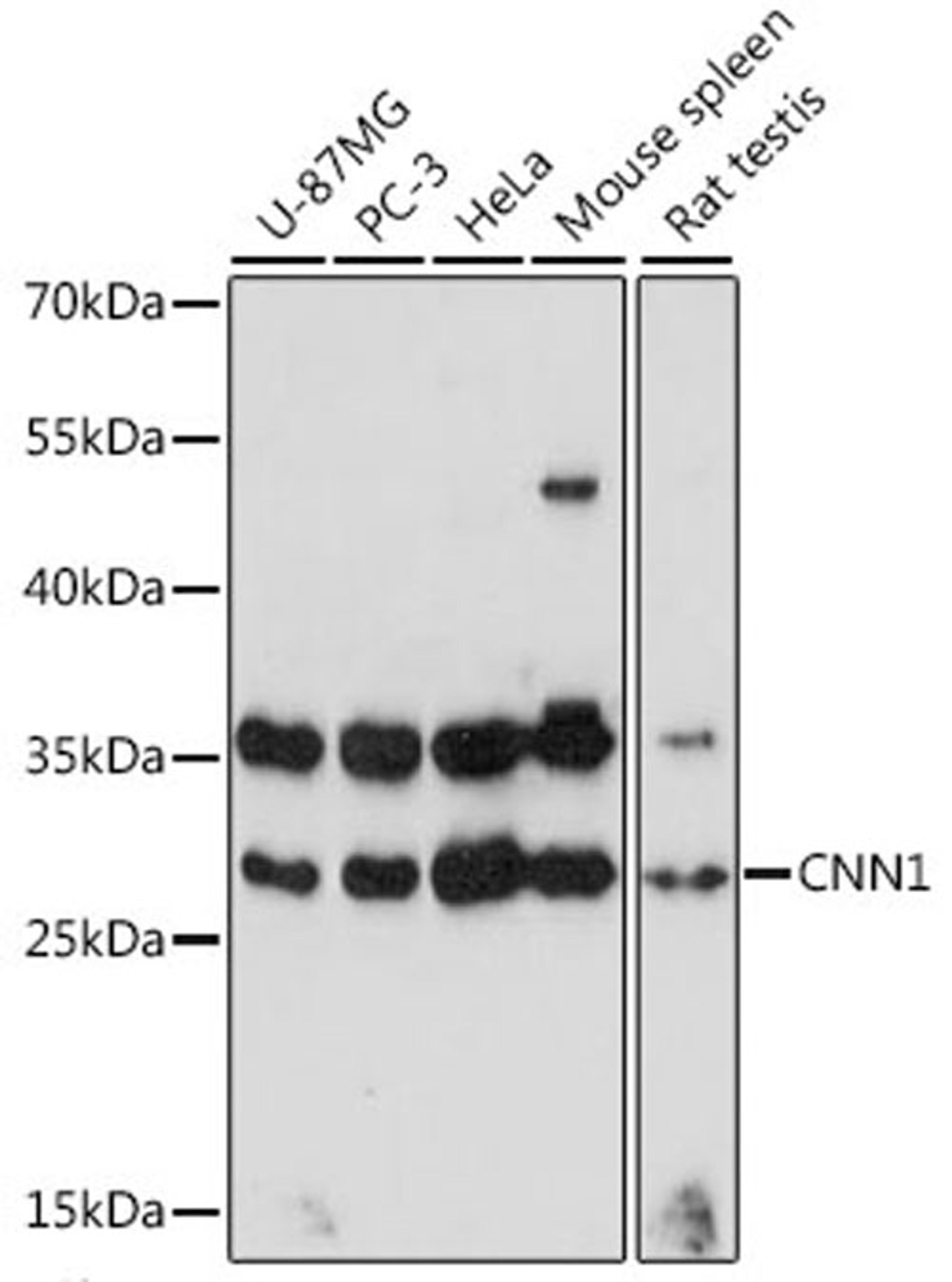 Western blot - CNN1 antibody (A16638)