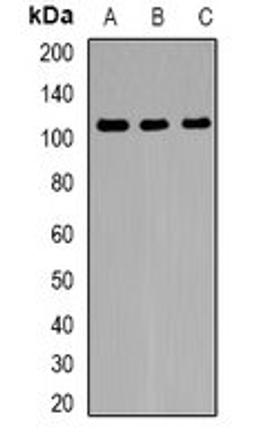 Western blot analysis of HeLa (Lane1), mouse brain (Lane2), rat brain (Lane3) whole cell lysates using PRPF40A antibody