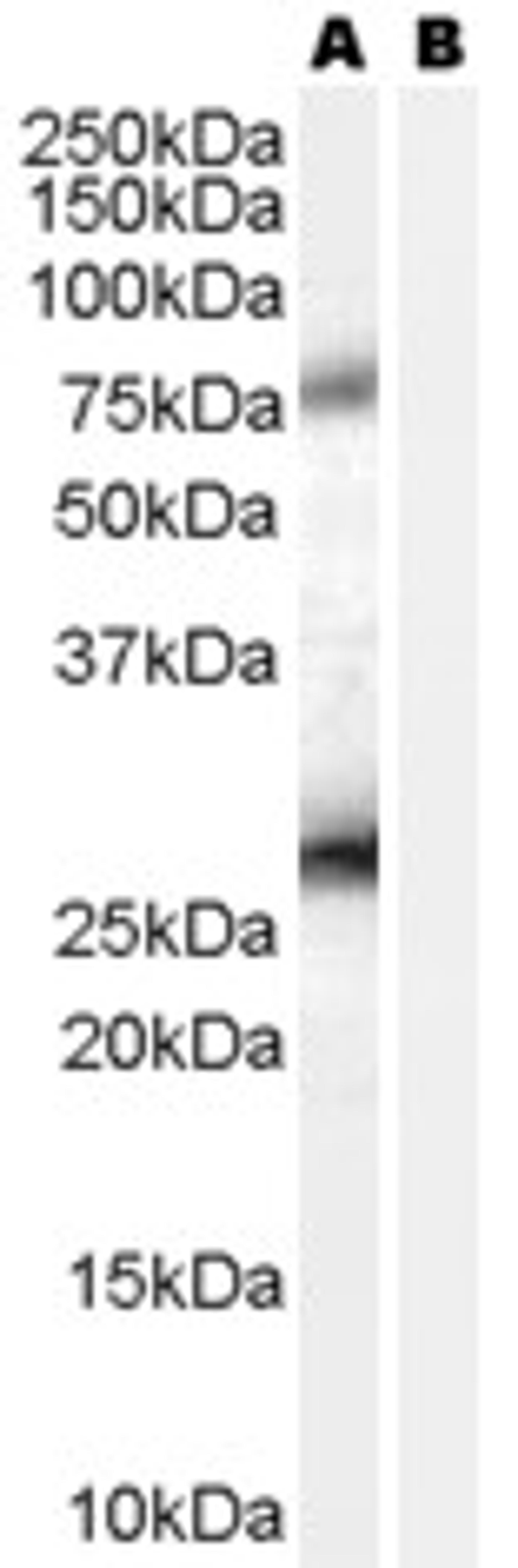 45-515 (0.2ug/ml) staining of A431 lysate (35ug protein in RIPA buffer) with (B) and without (A) blocking with the immunising peptide. Primary incubation was 1 hour. Detected by chemiluminescence.