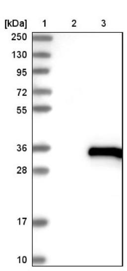 Western Blot: UBTD1 Antibody [NBP1-82311] - Lane 1: Marker [kDa] 250, 130, 95, 72, 55, 36, 28, 17, 10<br/>Lane 2: Negative control (vector only transfected HEK293T lysate)<br/>Lane 3: Over-expression lysate (Co-expressed with a C-terminal myc-DDK tag (~3.1 kDa) in mammalian HEK293T cells, LY410953)