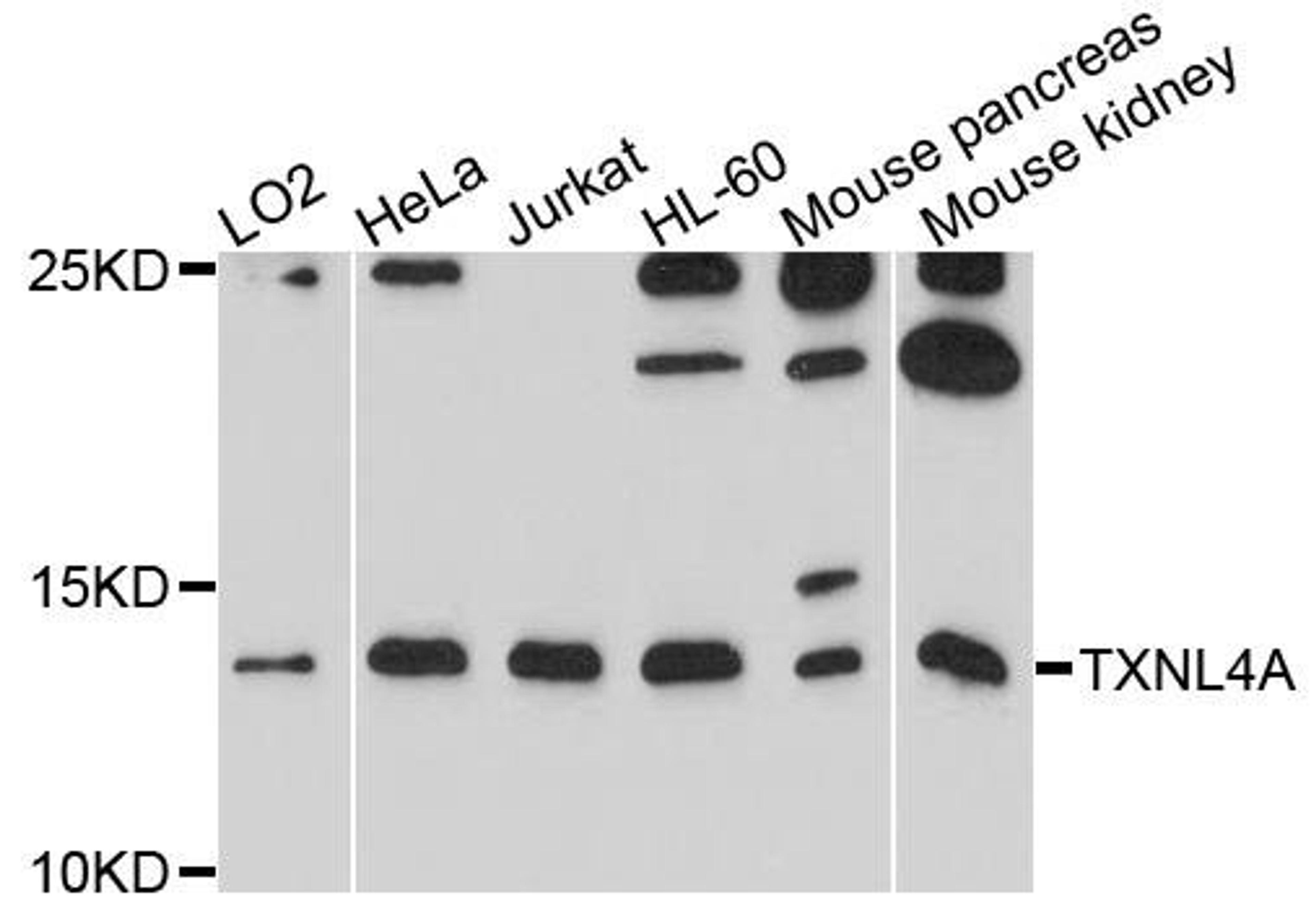 Western blot analysis of extracts of various cells using TXNL4A antibody