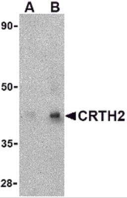 Western blot analysis of CRTH2 in human heart tissue lysate with CRTH2 antibody at (A) 1 and (B) 2 &#956;g/mL. 