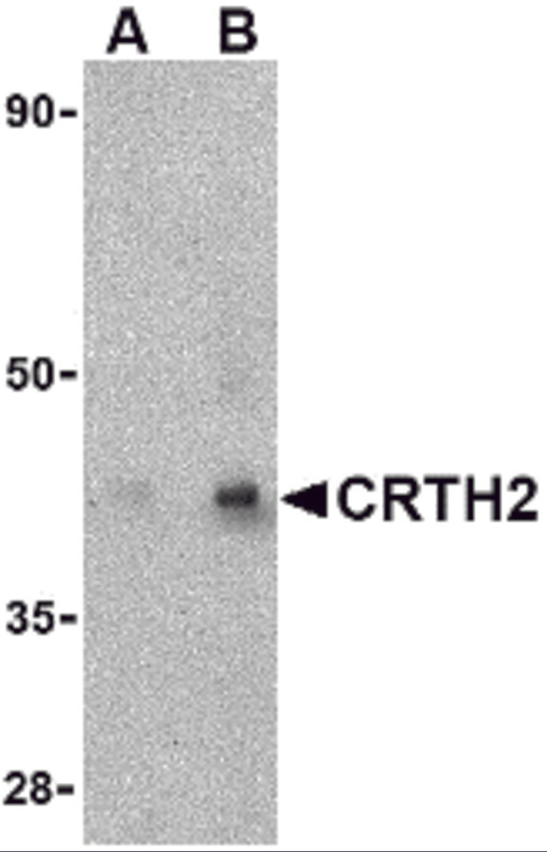 Western blot analysis of CRTH2 in human heart tissue lysate with CRTH2 antibody at (A) 1 and (B) 2 μg/mL.