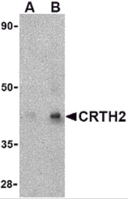 Western blot analysis of CRTH2 in human heart tissue lysate with CRTH2 antibody at (A) 1 and (B) 2 μg/mL.