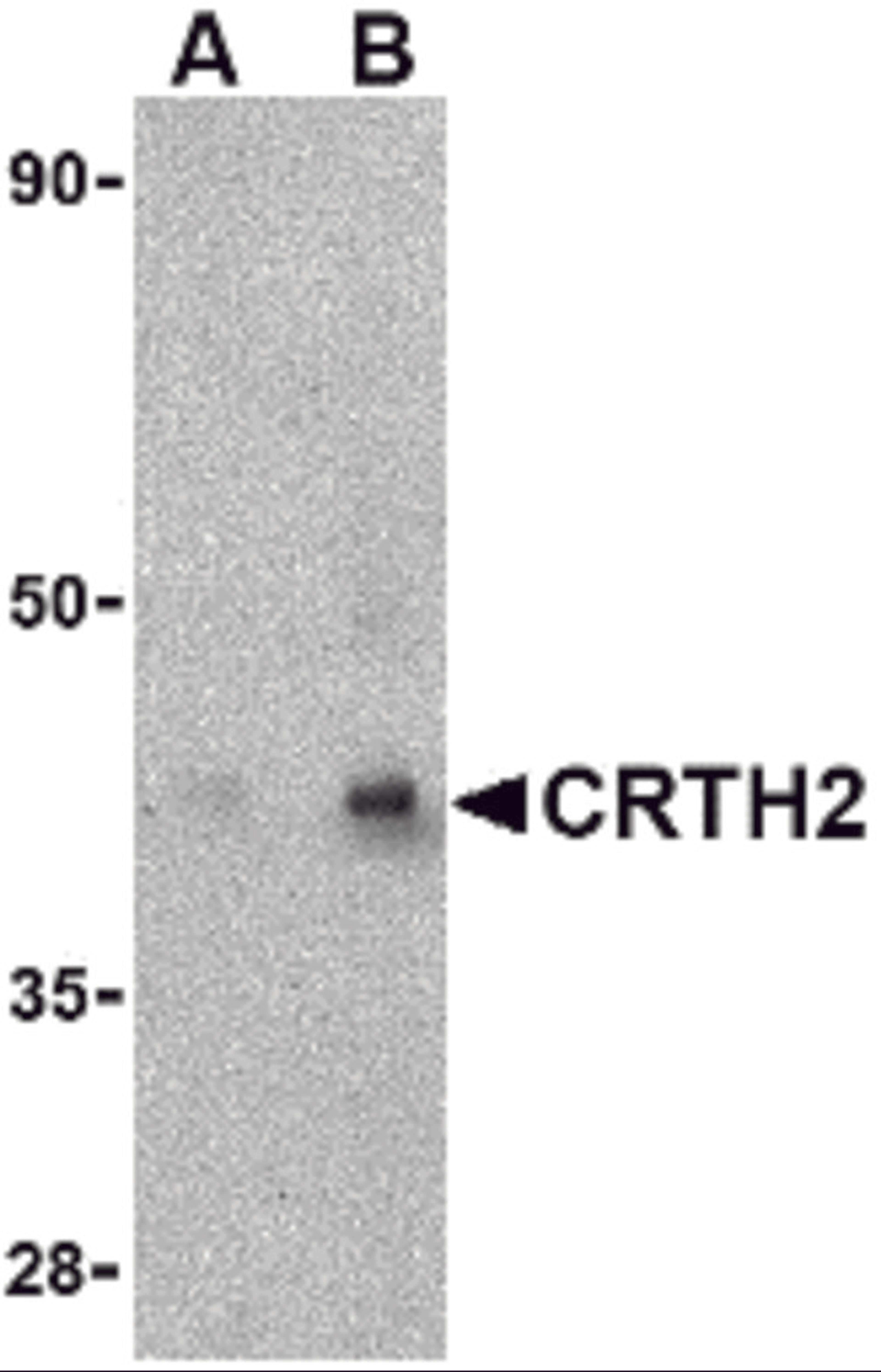 Western blot analysis of CRTH2 in human heart tissue lysate with CRTH2 antibody at (A) 1 and (B) 2 μg/mL.