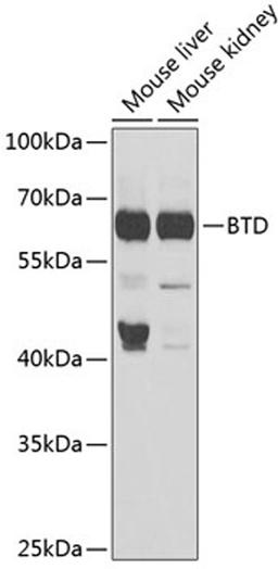 Western blot - BTD antibody (A6284)