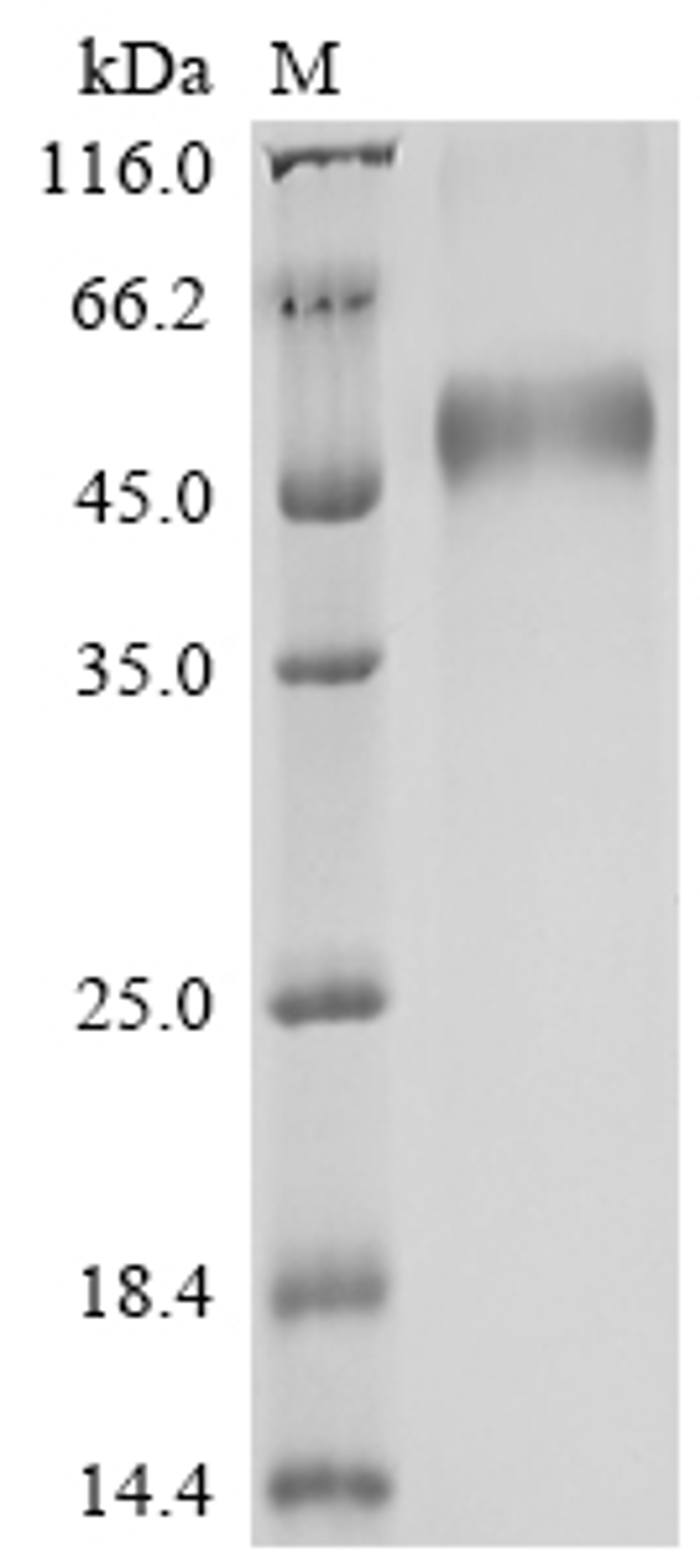 (Tris-Glycine gel) Discontinuous SDS-PAGE (reduced) with 5% enrichment gel and 15% separation gel.