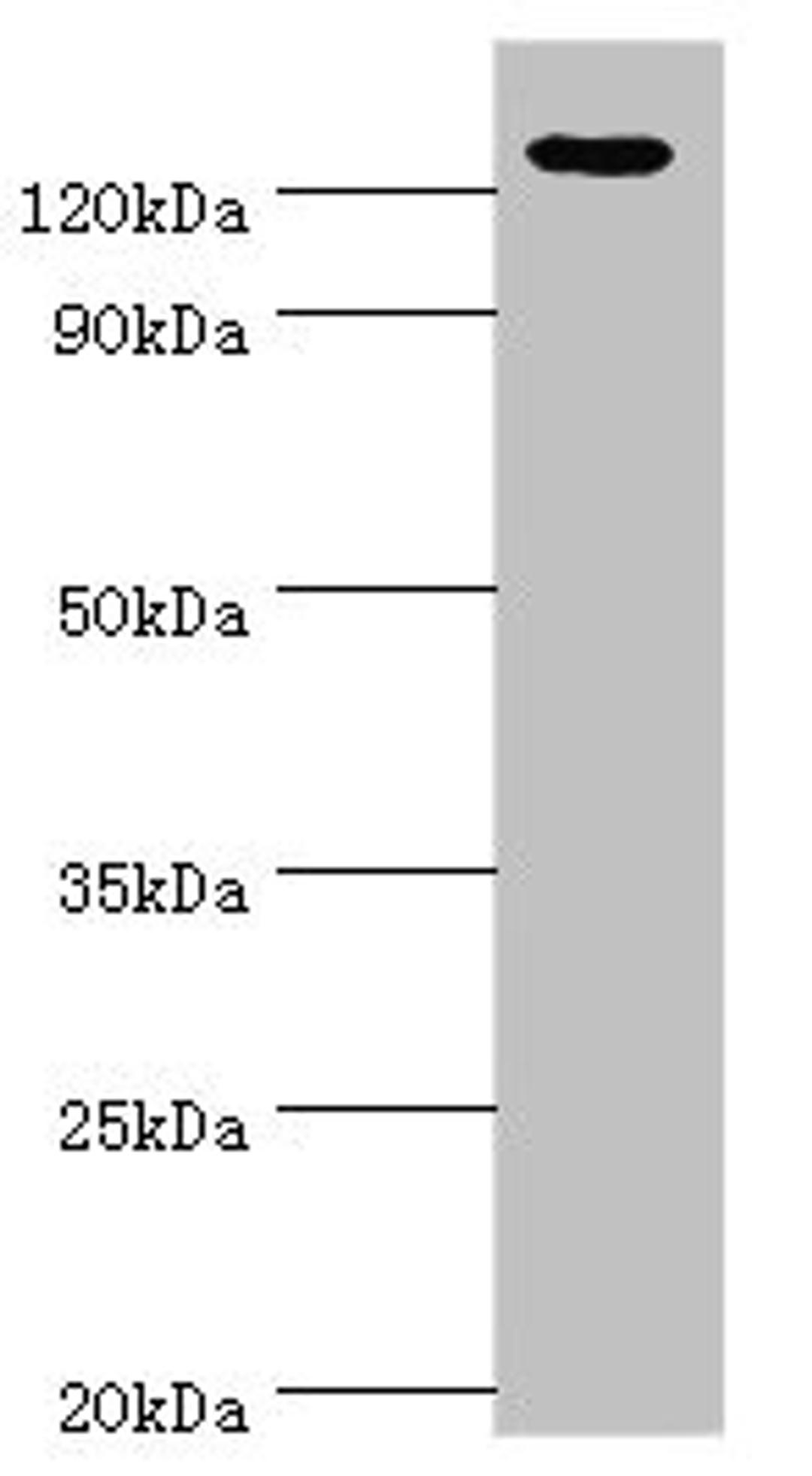 Western blot. All lanes: NLRP2 antibody at 12µg/ml + A431 whole cell lysate. Secondary. Goat polyclonal to rabbit IgG at 1/10000 dilution. Predicted band size: 121, 119, 97, 118 kDa. Observed band size: 121 kDa