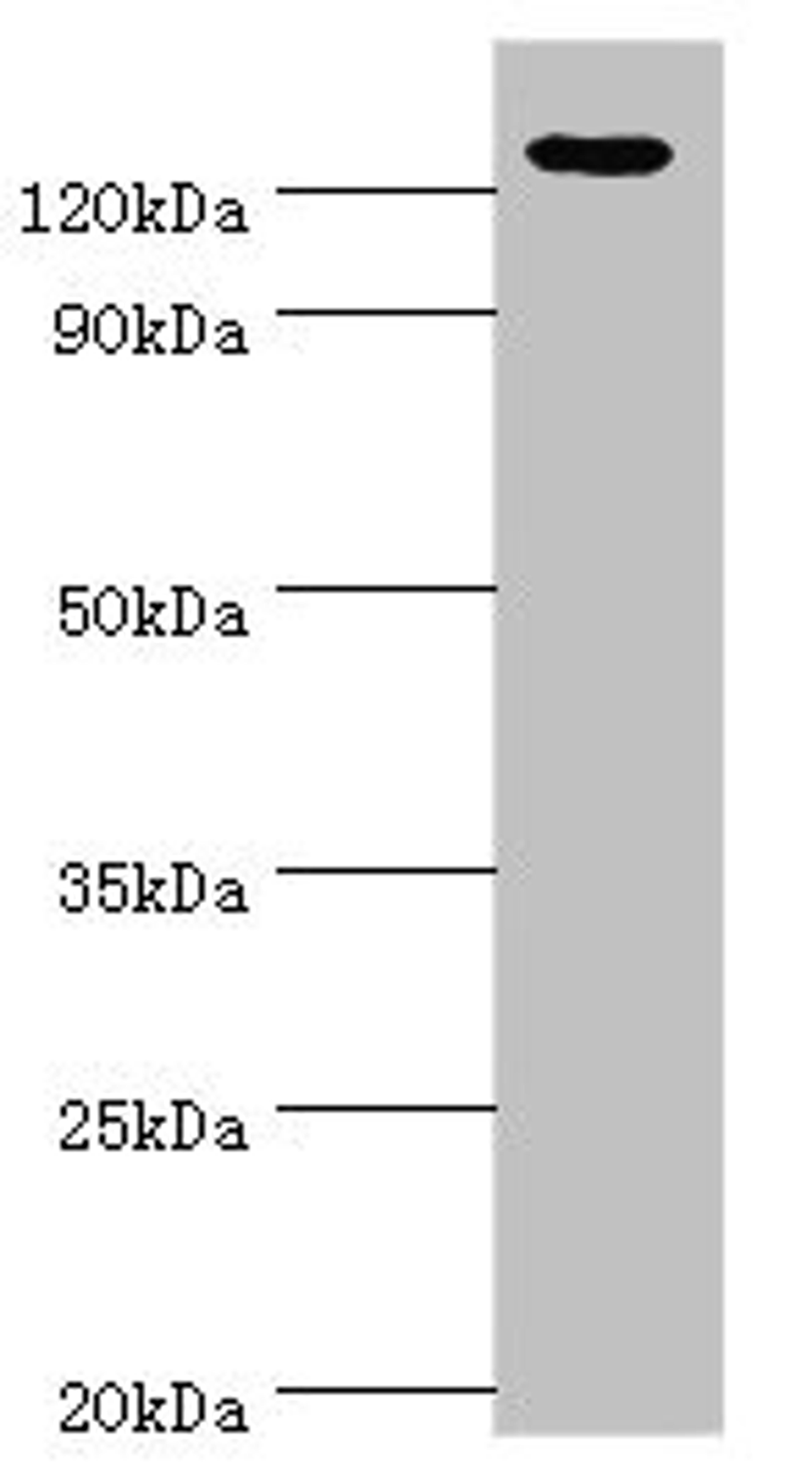Western blot. All lanes: NLRP2 antibody at 12µg/ml + A431 whole cell lysate. Secondary. Goat polyclonal to rabbit IgG at 1/10000 dilution. Predicted band size: 121, 119, 97, 118 kDa. Observed band size: 121 kDa