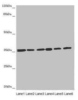 Western blot. All lanes: ETFA antibody at 4.34µg/ml. Lane 1: A431 whole cell lysate. Lane 2: Hela whole cell lysate. Lane 3: K562 whole cell lysate. Lane 4: A549 whole cell lysate. Lane 5: HepG2 whole cell lysate. Lane 6: MCF-7 whole cell lysate. Secondary. Goat polyclonal to rabbit IgG at 1/10000 dilution. Predicted band size: 36, 31 kDa. Observed band size: 36 kDa