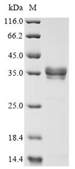 (Tris-Glycine gel) Discontinuous SDS-PAGE (reduced) with 5% enrichment gel and 15% separation gel.