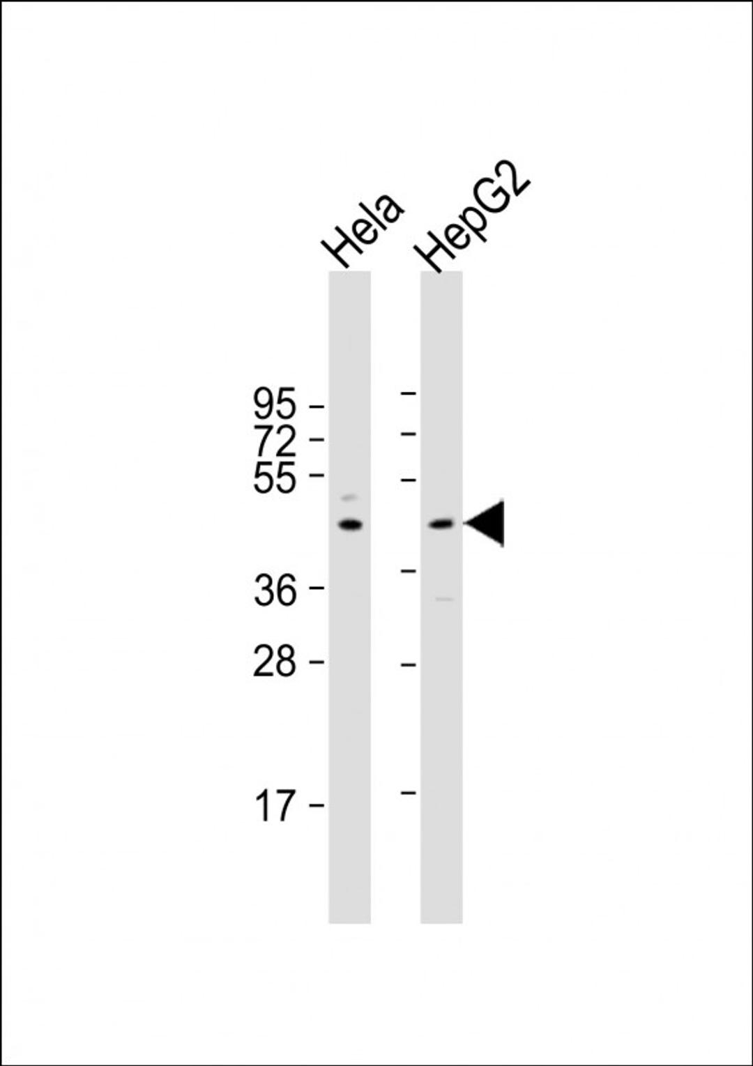 Western Blot at 1:2000 dilution Lane 1: Hela whole cell lysate Lane 2: HepG2 whole cell lysate Lysates/proteins at 20 ug per lane.