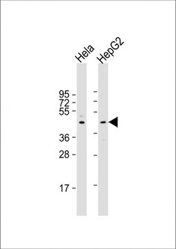 Western Blot at 1:2000 dilution Lane 1: Hela whole cell lysate Lane 2: HepG2 whole cell lysate Lysates/proteins at 20 ug per lane.