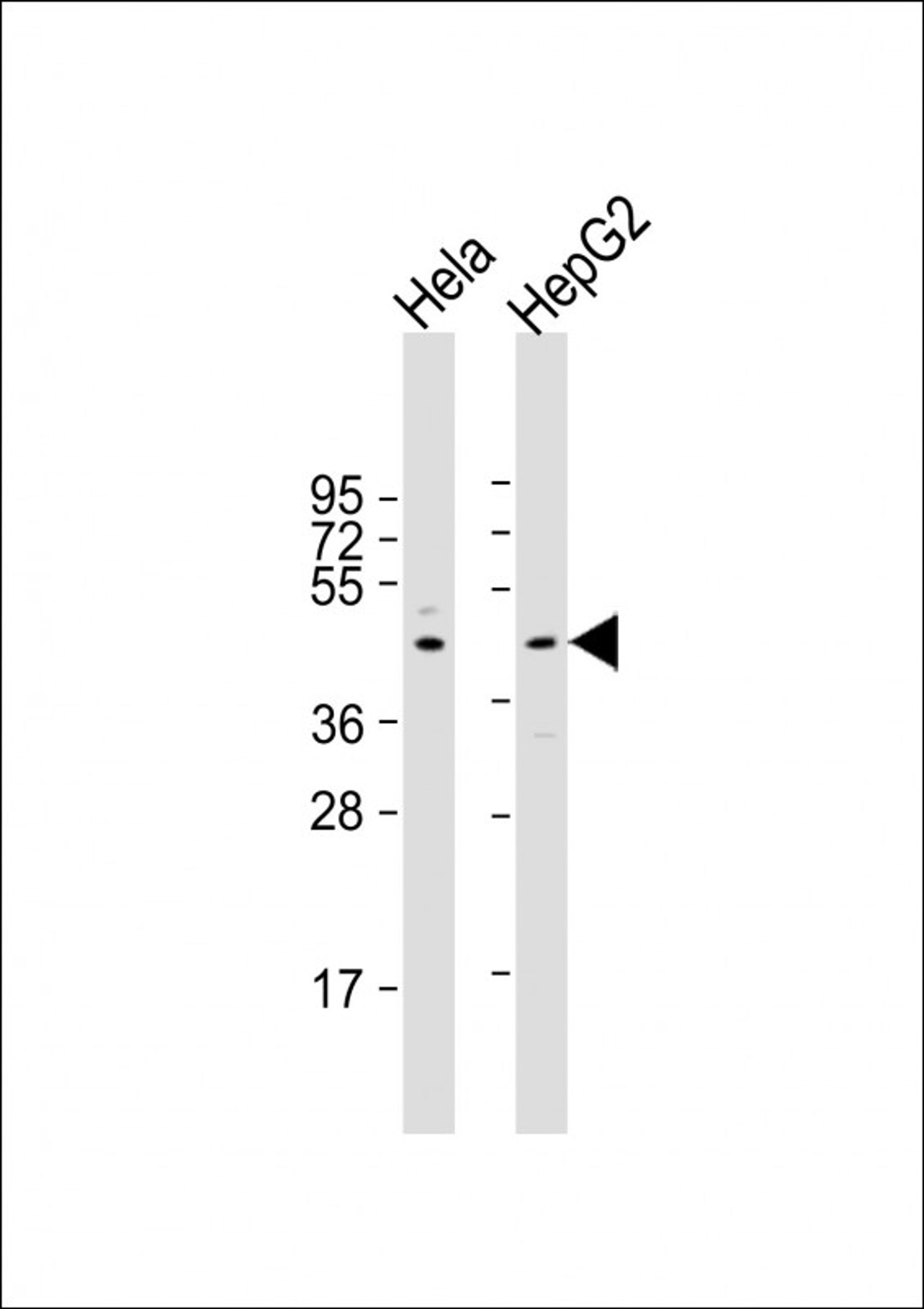 Western Blot at 1:2000 dilution Lane 1: Hela whole cell lysate Lane 2: HepG2 whole cell lysate Lysates/proteins at 20 ug per lane.