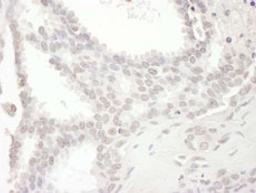 Detection of human SPIN90 by immunohistochemistry.