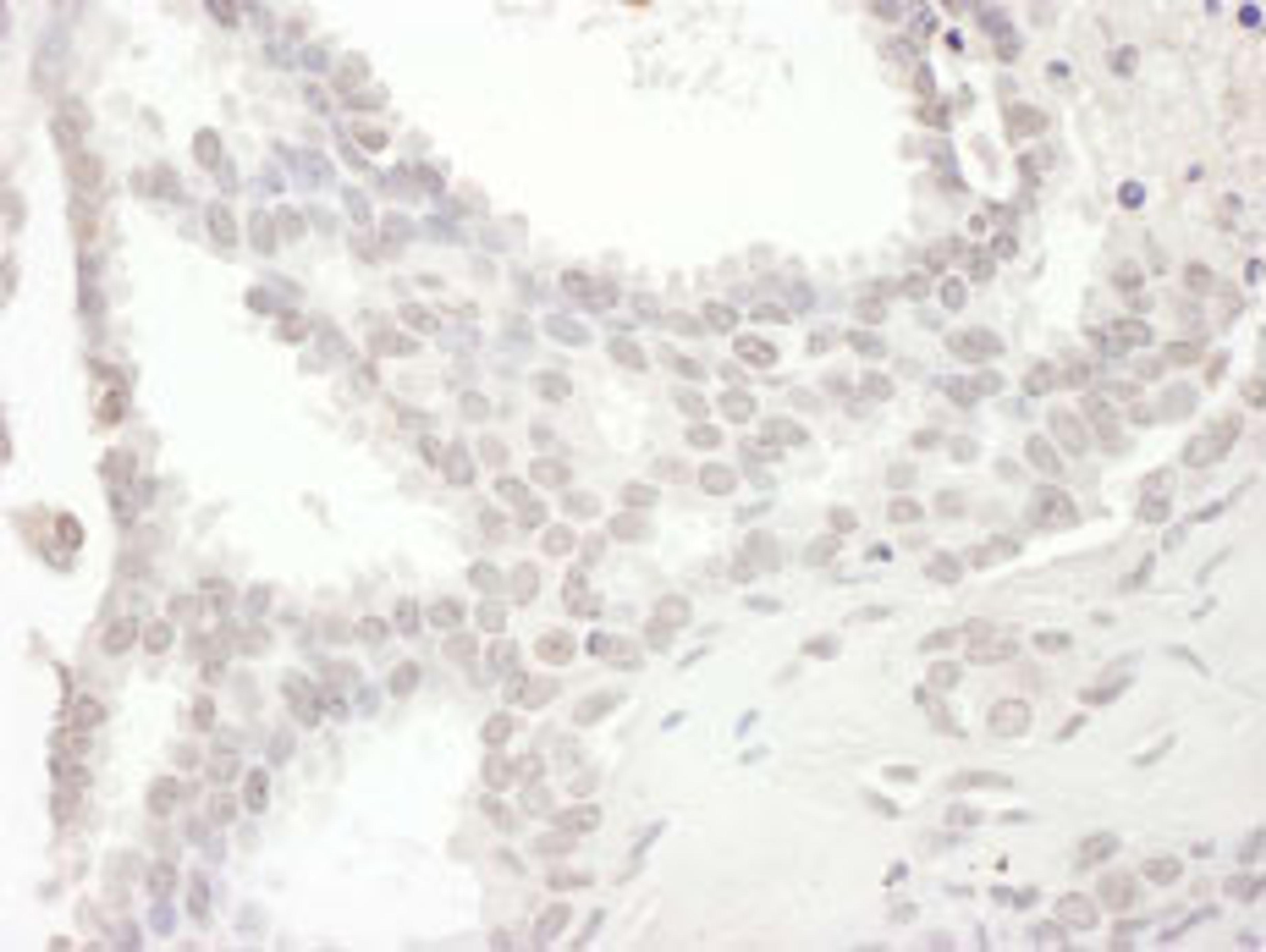 Detection of human SPIN90 by immunohistochemistry.