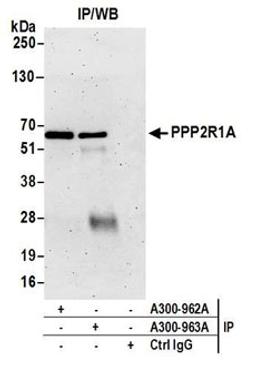 Detection of human PPP2R1A by western blot of immunoprecipitates.